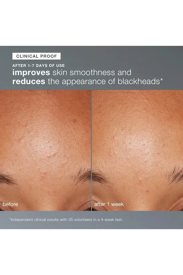 daily microfoliant exfoliator