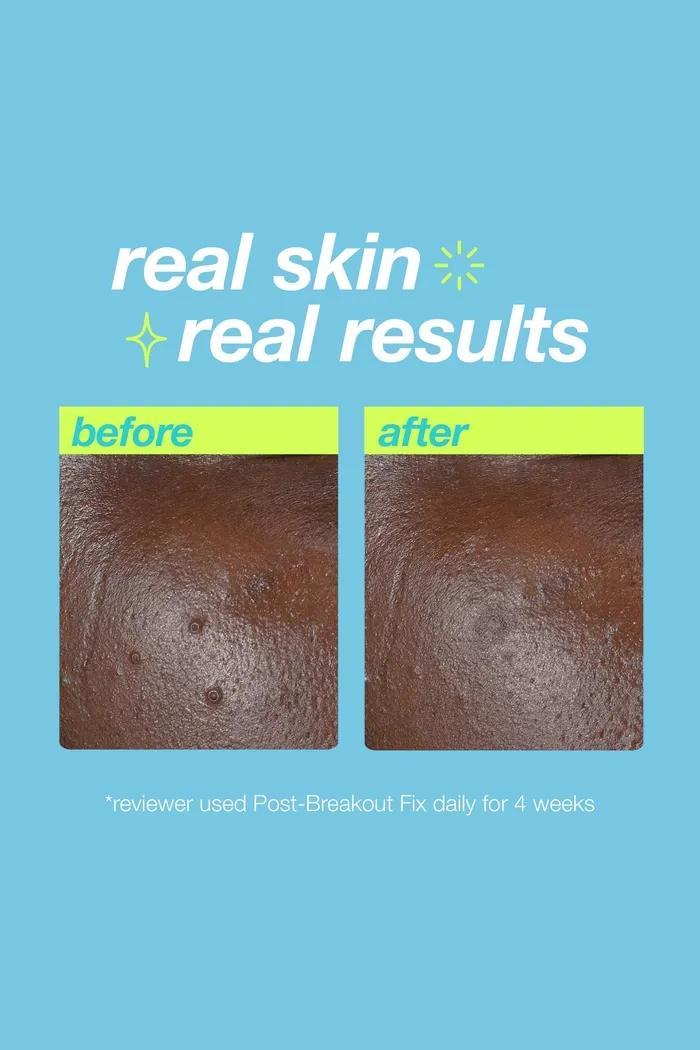 Средство против следов после высыпаний