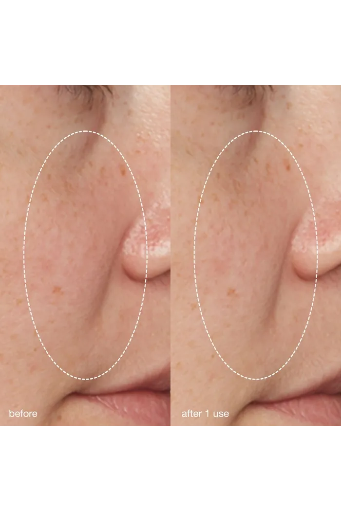 жидкий пилинг-эксфолиант