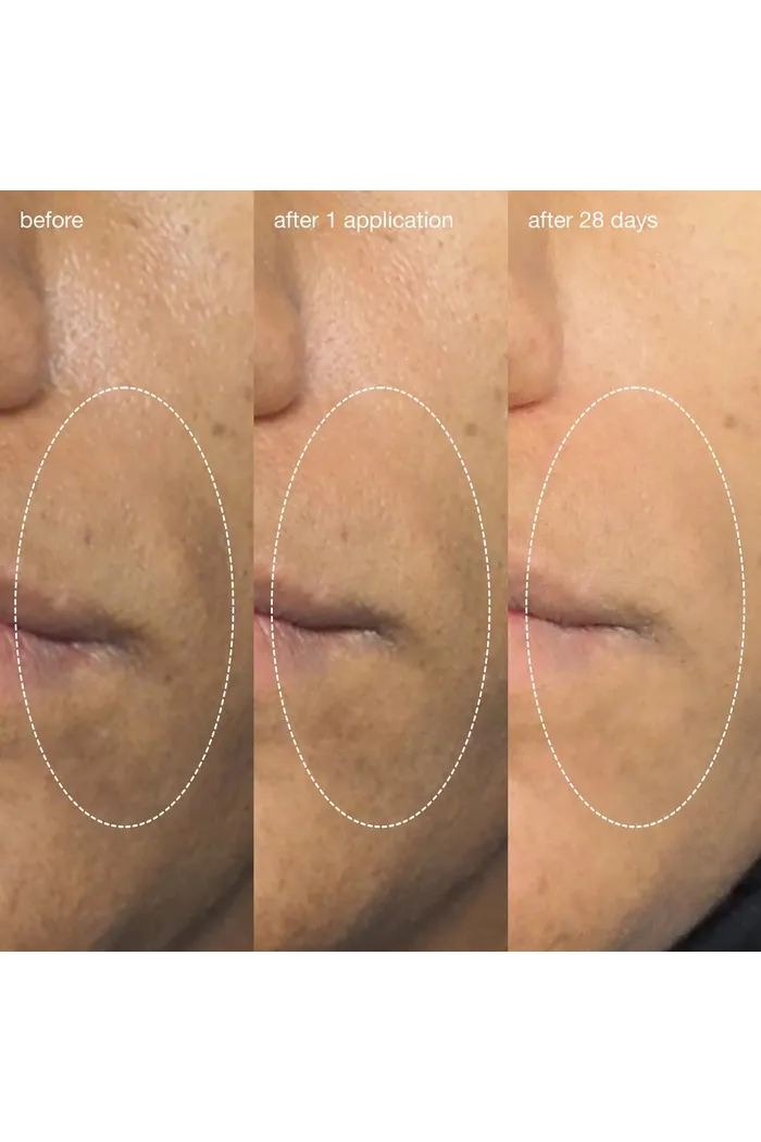 жидкий пилинг-эксфолиант