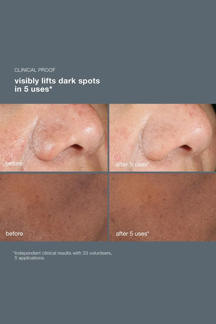 powerbright dark spot peel