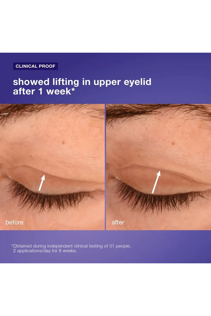 phyto nature lifting eye cream