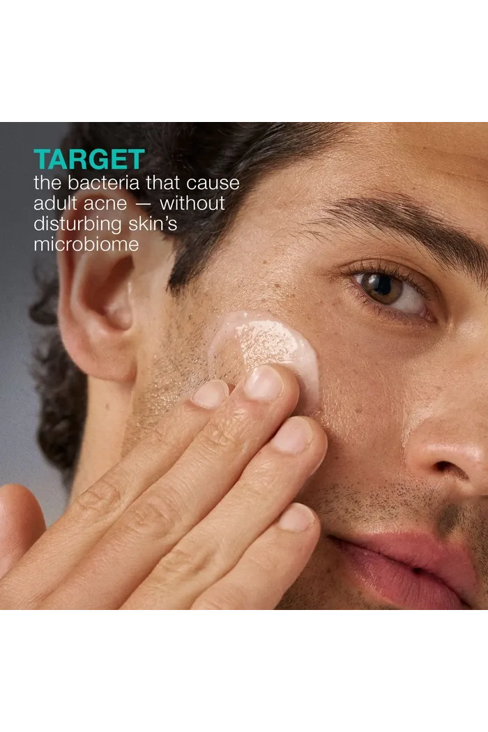 Увлажняющий крем Acne Biotic для проблемной кожи